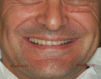 clinica dental bilbao alustiza estetica dental
