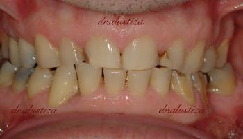 clinica dental alustiza bilbao ortodoncia