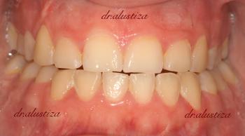 clinica dental bilbao alustiza asimetria