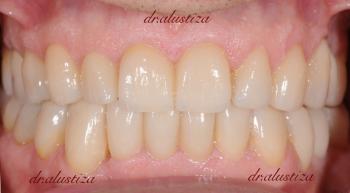 clinica dental alustiza cambio estetica