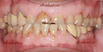 clinica dental alustiza estetica