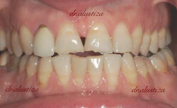 clinica dental bilbao alustiza ferula