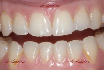 clinica dental alustiza bilbao especialista ortodoncias