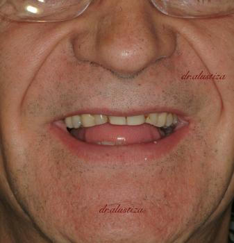 clinica dental alustiza mejora funcionalidad