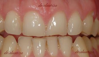 clinica dental alustiza bilbao ortodoncia