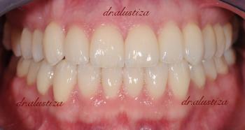 clinica dental alustiza ortodoncia estetica