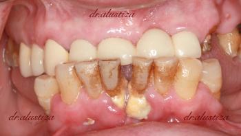 clinica dental alustiza bilbao estetica