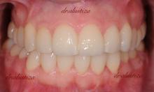 clinica dental bilbao alustiza osteopatia ortodoncia
