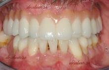 clinica dental bilbao alustiza ortodoncia